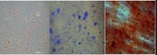 Mezenchymálne stromálne bunky (MSB) izolované z podkožného tuku diferencované do adipocytov, chondrocytov a osteoblastov.