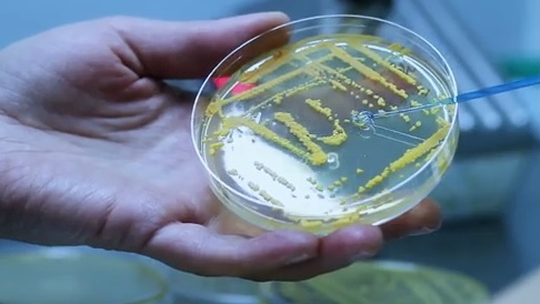 Petriho miska s mikroorganizmami