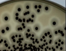 Kolónie rodu Stafylococcus na selektívno-diagnostickom médiu Baird-Parker