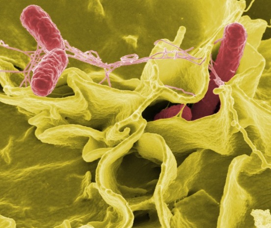 ilustračné foto: baktéria