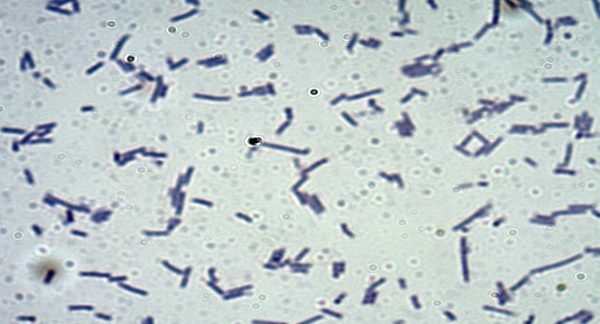 Lactobacillus plantarum LS/07