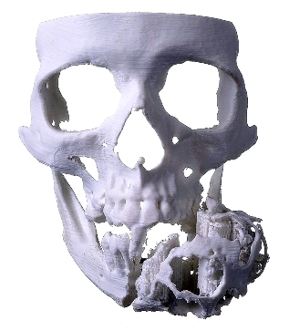 ukážka lebky vytvorenej 3D tlačou