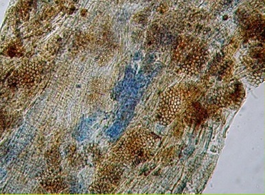 Mycélium a cystosorusy huby Polymyxa betae v koreňoch repy pestovanej v pôde infikovanej vírusom BNYVV
