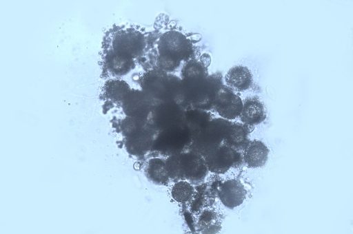 Zhluk buniek s mukóznym plášťom druhu Gonostomumkuehnelti