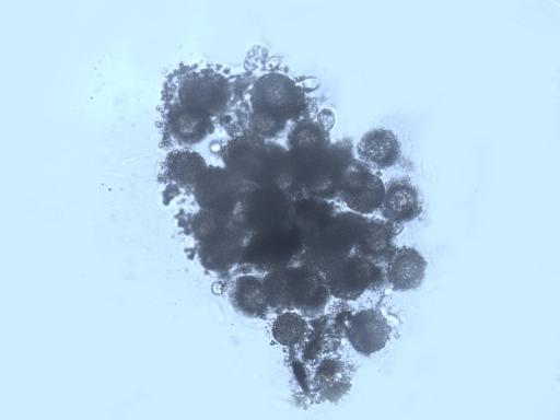 Zhluk buniek s mukóznym plášťom druhu Gonostomumkuehnelti