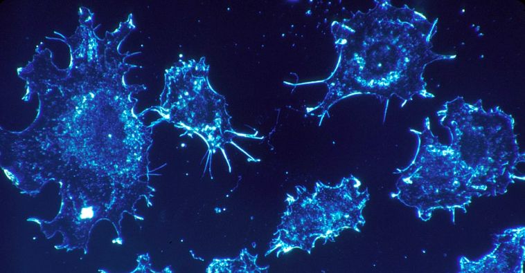 Ilustračná fotografia rakovinových buniek. Zdroj: Pixabay.com
