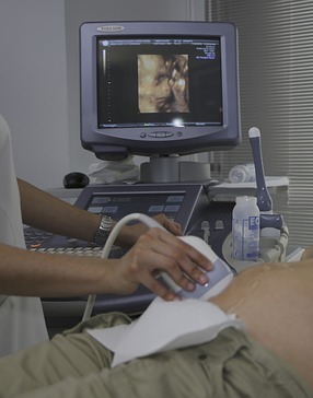 ilustračné foto / ultrazvuk