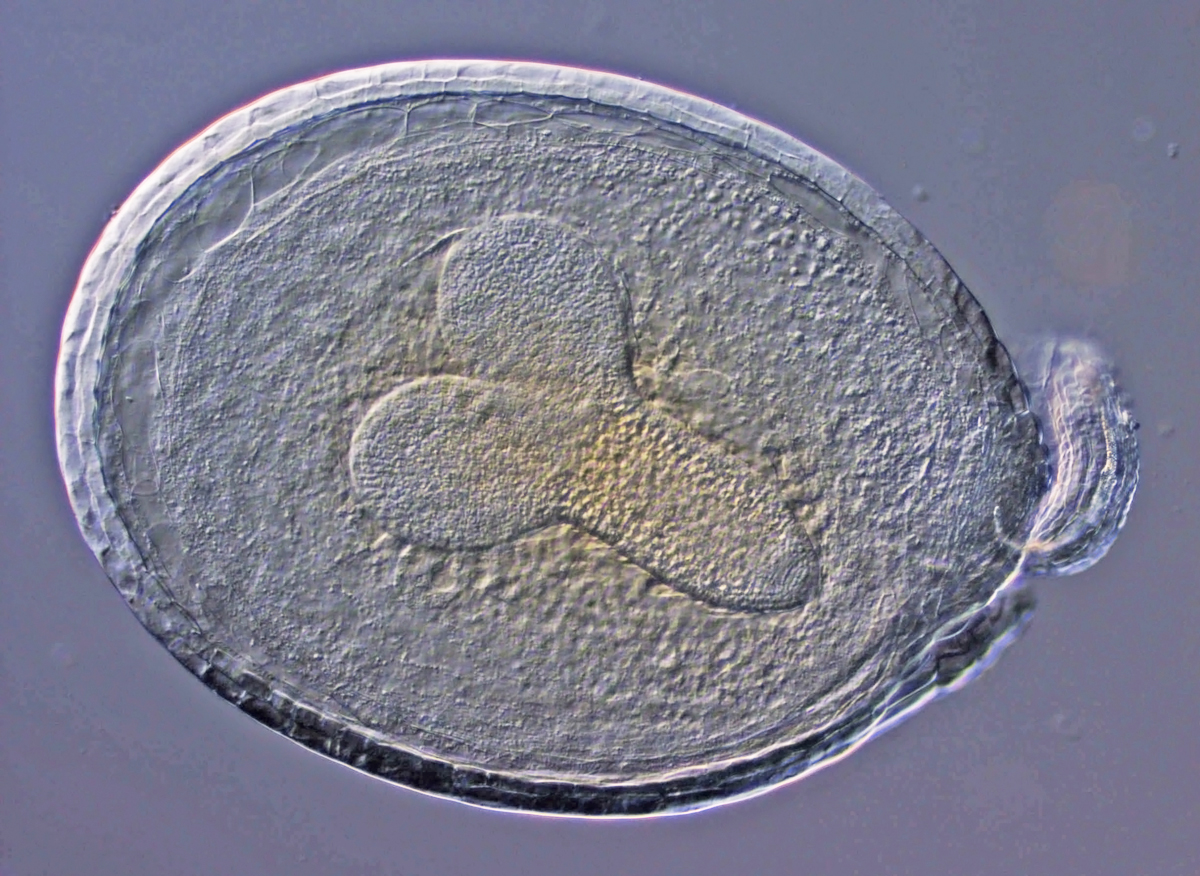 Vyvíjajúce sa embryo najčastejšie skúmanej pokusnej rastliny (Arabidopsis thaliana). Auxiny a cytokininy pomáhajú určiť, kde bude v zárodku vrchol stonky a kde špička koreňa. Foto Jan Petrášek.