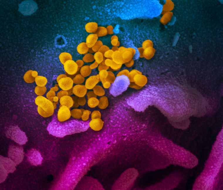 Obrázok spod mikroskopu, SARS-CoV-2 (žltou). FOTO: NIAID