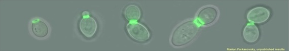 Septín v živých kvasinkových bunkách v rôznych štádiach bunkového cyklu (značený fluorescenčným proteínom).