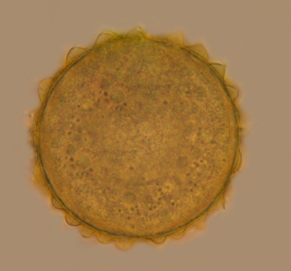 Sýtožltá cysta druhu Cyrtohymenaquadrinucleatas kužeľovitými výbežkami
