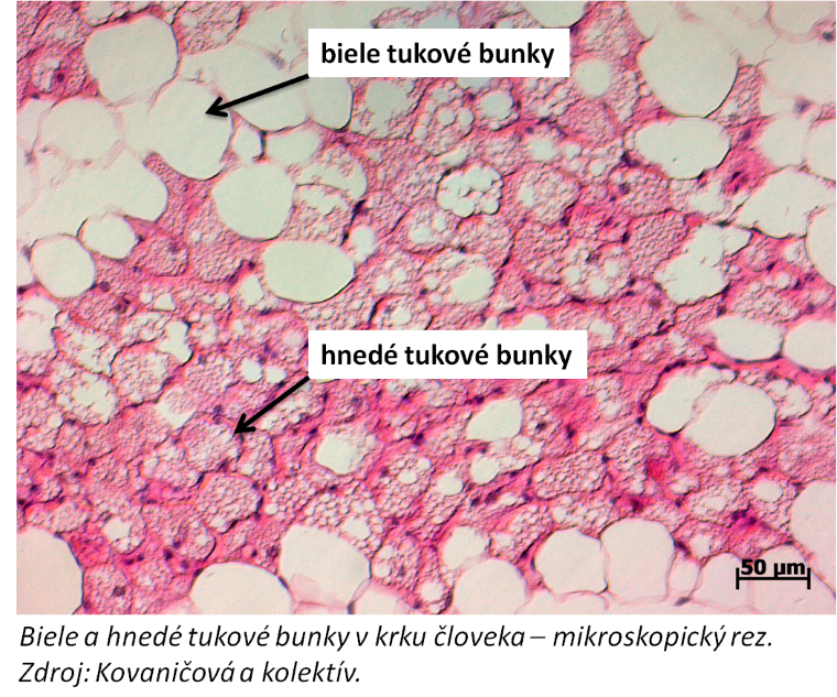 Biele a hnedé tukové bunky v krku človeka - mikroskopický rez. Zdroj: Kovaničová a kolektív