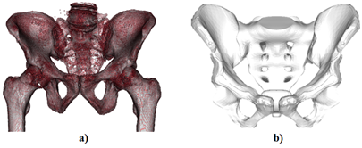 Obr. 2 Výsledný 3D model ľudskej panvy, a) vizualizácia, b) fyzický 3D model