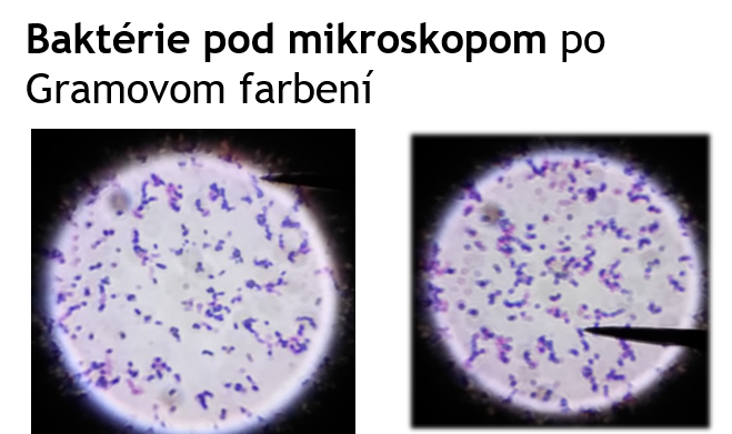 Baktérie pod mikroskopom, Zdroj: Archív AM
