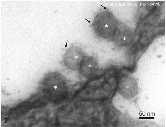 Detail vírusových častíc (biele hviezdičky). Šípky – glykoproteínové výbežky (tzv. Spike protein) na povrchu vírusových častíc, voči ktorému je zacielená väčšina vyvíjaných vakcín (50 nm=0,00000005 m), Zdroj: Biomedicínske centrum SAV