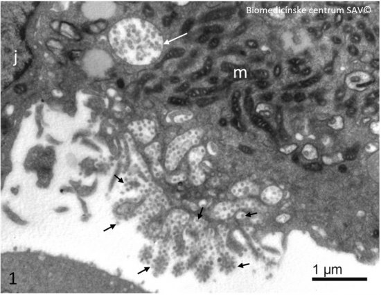 Vírusové častice SARS CoV-2 na povrchu bunky v oblasti aktívnej plazmalémy (krátke šípky) a vo vakuole cytosólu bunky (biela šípka). j – bunkové jadro, m – mitochondrie. Zdroj: Biomedicínske centrum SAV